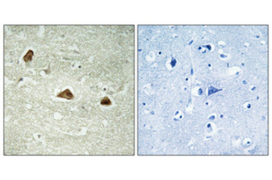 Immunohistochemistry - Anti-Keratin 18 (phospho Ser52) Antibody (A0882) - Antibodies.com