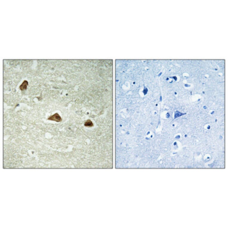 Immunohistochemistry - Anti-Keratin 18 (phospho Ser52) Antibody (A0882) - Antibodies.com