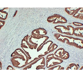 Immunohistochemistry - Anti-Prostatic Acid Phosphatase Antibody (V0118) - Antibodies.com