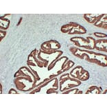 Immunohistochemistry - Anti-Prostatic Acid Phosphatase Antibody (V0118) - Antibodies.com