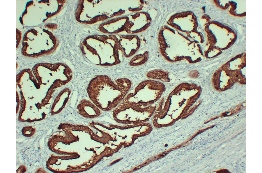 Immunohistochemistry - Anti-Prostatic Acid Phosphatase Antibody (V0118) - Antibodies.com