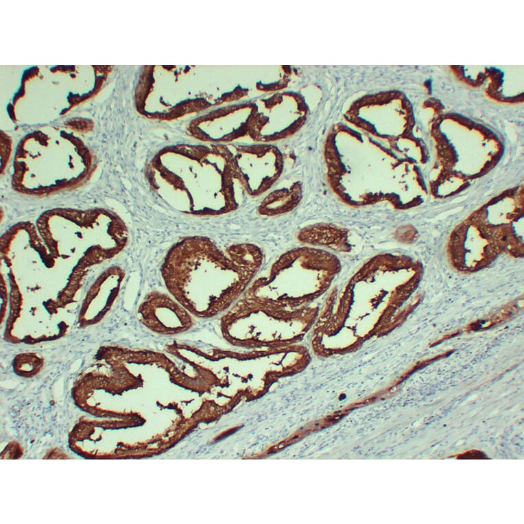 Immunohistochemistry - Anti-Prostatic Acid Phosphatase Antibody (V0118) - Antibodies.com
