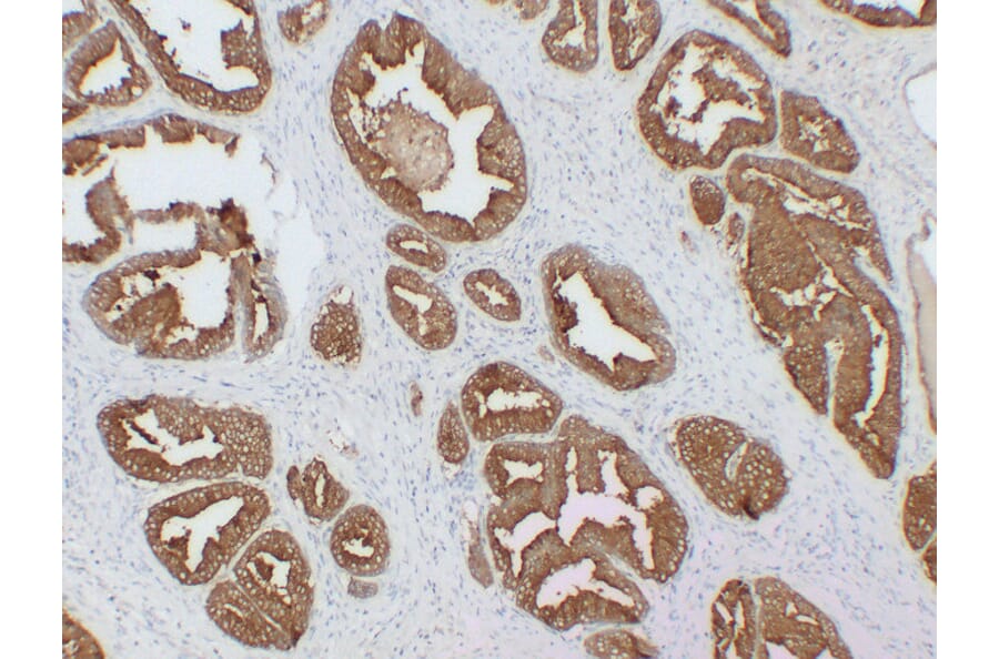 Immunohistochemistry - Anti-Prostatic Acid Phosphatase Antibody (V0118) - Antibodies.com