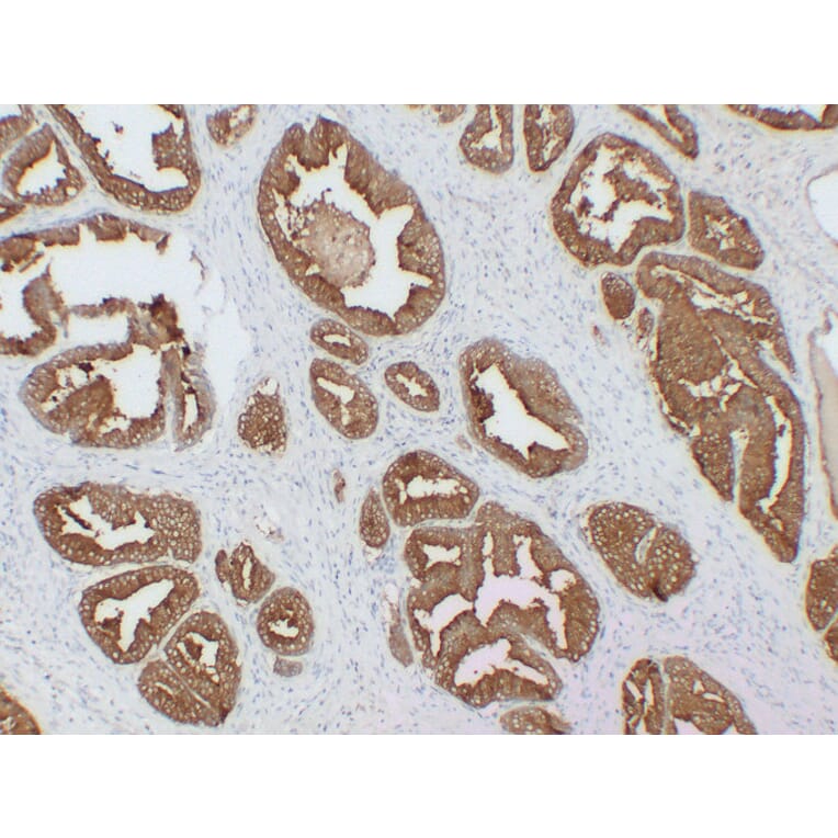 Immunohistochemistry - Anti-Prostatic Acid Phosphatase Antibody (V0118) - Antibodies.com