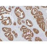 Immunohistochemistry - Anti-Prostatic Acid Phosphatase Antibody (V0118) - Antibodies.com