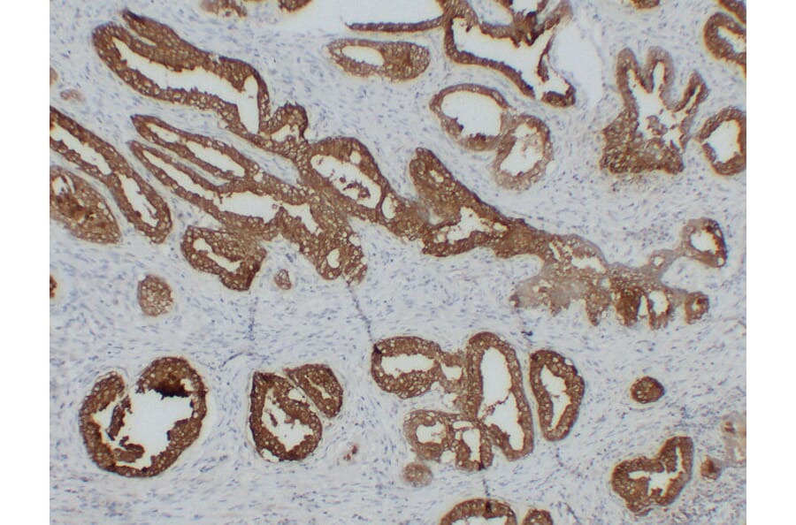 Immunohistochemistry - Anti-Prostatic Acid Phosphatase Antibody (V0118) - Antibodies.com