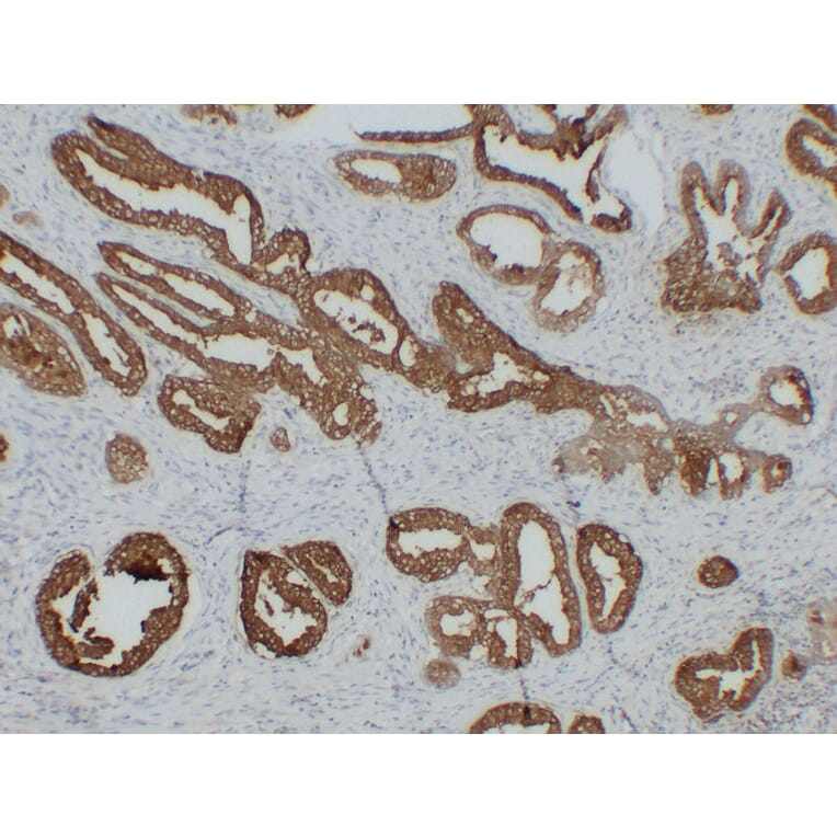 Immunohistochemistry - Anti-Prostatic Acid Phosphatase Antibody (V0118) - Antibodies.com