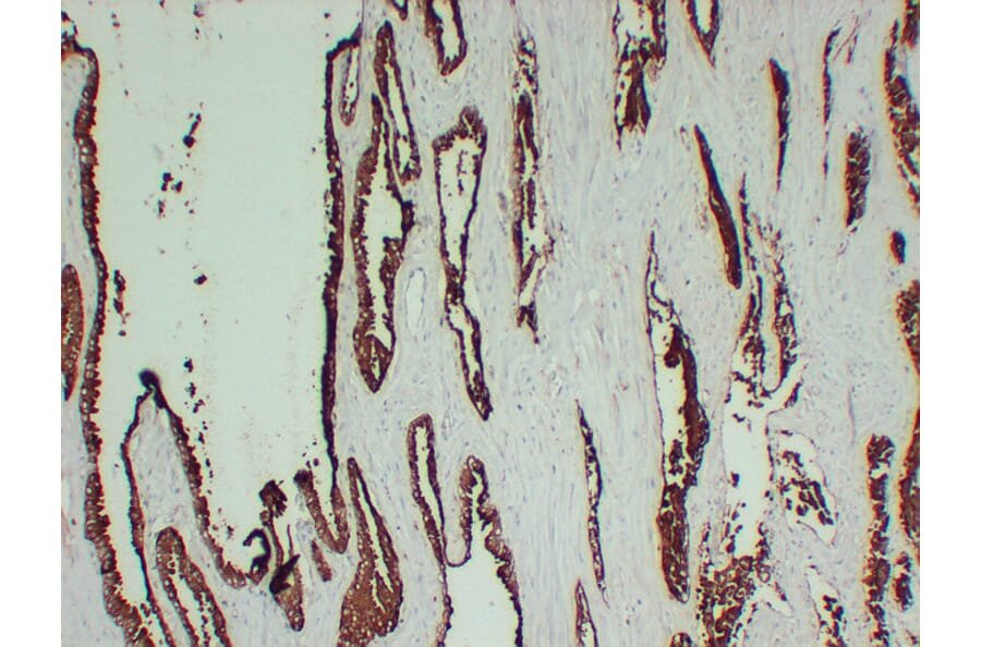 Immunohistochemistry - Anti-Prostatic Acid Phosphatase Antibody (V0118) - Antibodies.com
