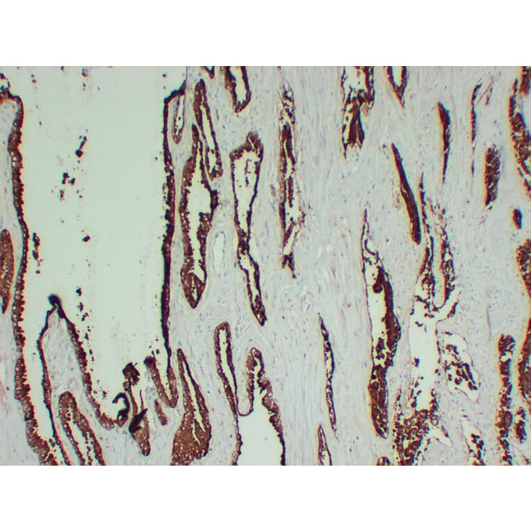Immunohistochemistry - Anti-Prostatic Acid Phosphatase Antibody (V0118) - Antibodies.com