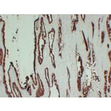 Immunohistochemistry - Anti-Prostatic Acid Phosphatase Antibody (V0118) - Antibodies.com