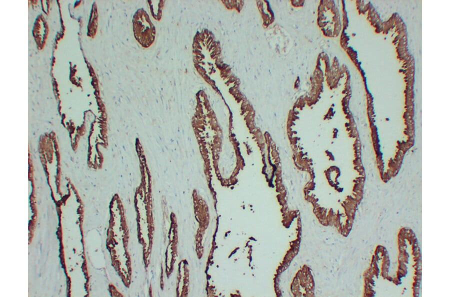 Immunohistochemistry - Anti-Prostatic Acid Phosphatase Antibody (V0118) - Antibodies.com