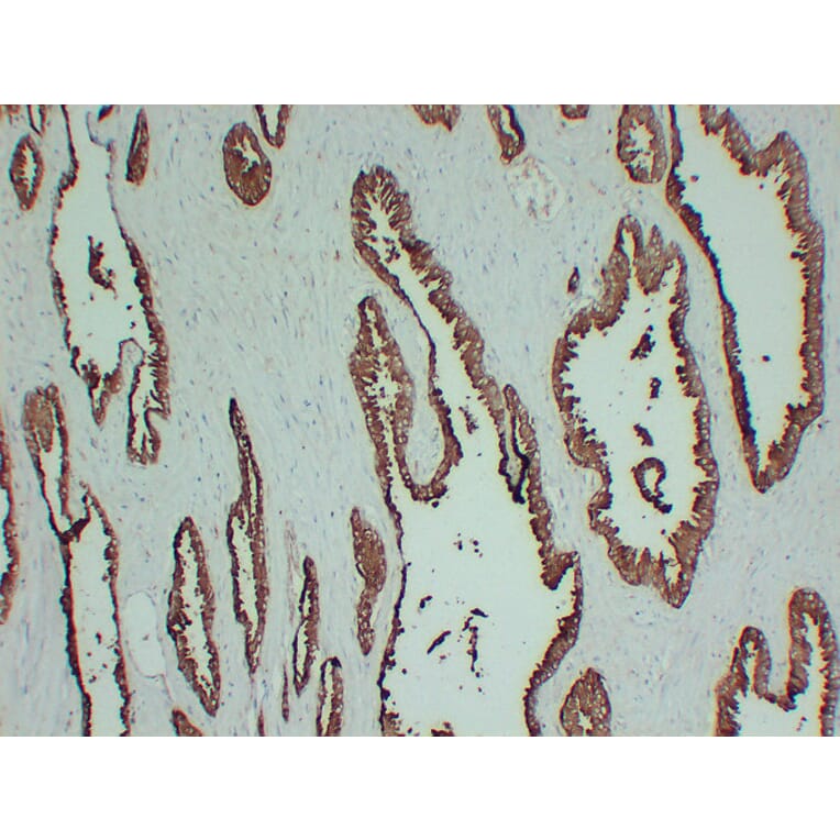 Immunohistochemistry - Anti-Prostatic Acid Phosphatase Antibody (V0118) - Antibodies.com