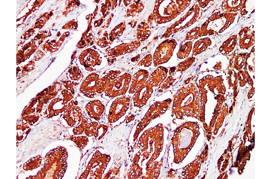 Immunohistochemistry - Anti-Prostatic Acid Phosphatase Antibody (V0118) - Antibodies.com