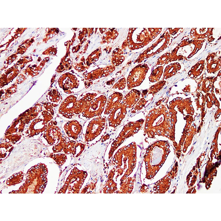 Immunohistochemistry - Anti-Prostatic Acid Phosphatase Antibody (V0118) - Antibodies.com