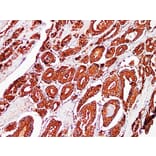 Immunohistochemistry - Anti-Prostatic Acid Phosphatase Antibody (V0118) - Antibodies.com