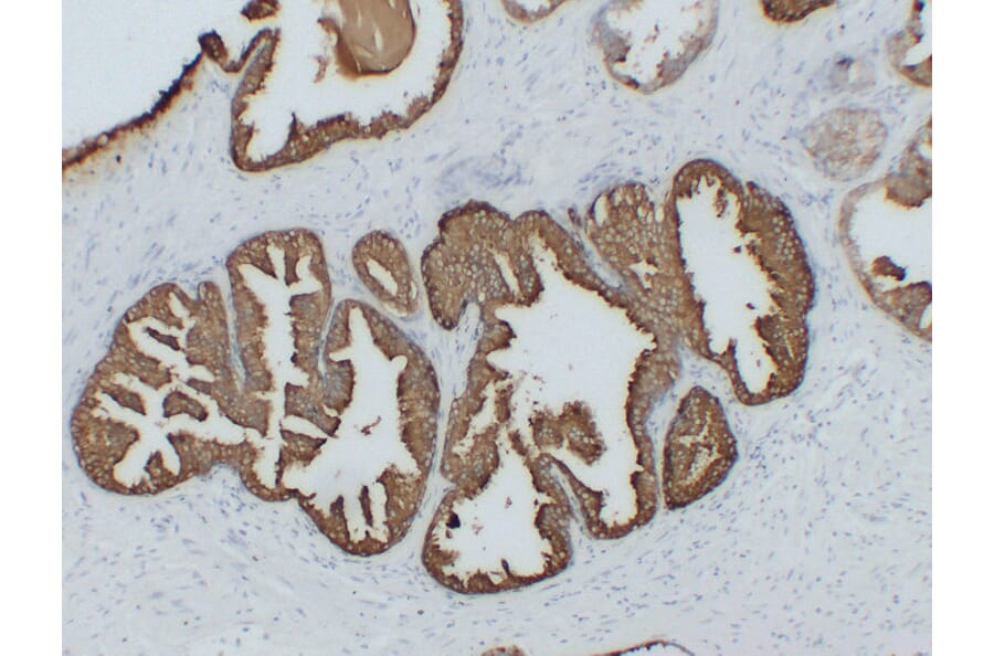 Immunohistochemistry - Anti-Prostatic Acid Phosphatase Antibody (V0118) - Antibodies.com