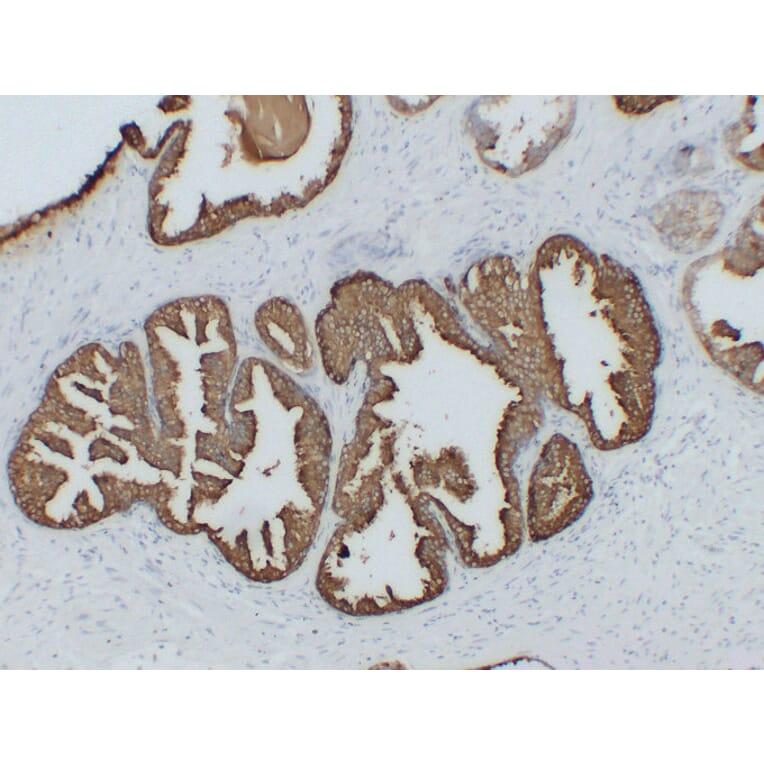 Immunohistochemistry - Anti-Prostatic Acid Phosphatase Antibody (V0118) - Antibodies.com