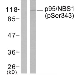 Western Blot - Anti-p95/NBS1 (phospho Ser343) Antibody (A7160) - Antibodies.com