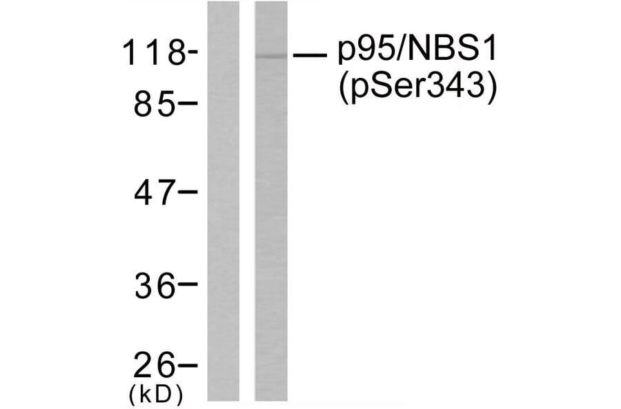 Western Blot - Anti-p95/NBS1 (phospho Ser343) Antibody (A7160) - Antibodies.com