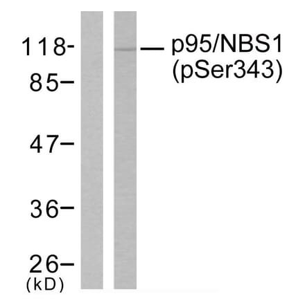 Western Blot - Anti-p95/NBS1 (phospho Ser343) Antibody (A7160) - Antibodies.com