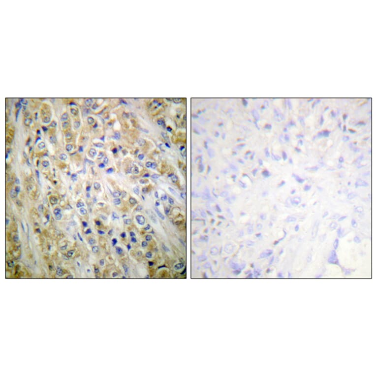Immunohistochemistry - Anti-Prostate-specific Antigen Antibody (C0311) - Antibodies.com