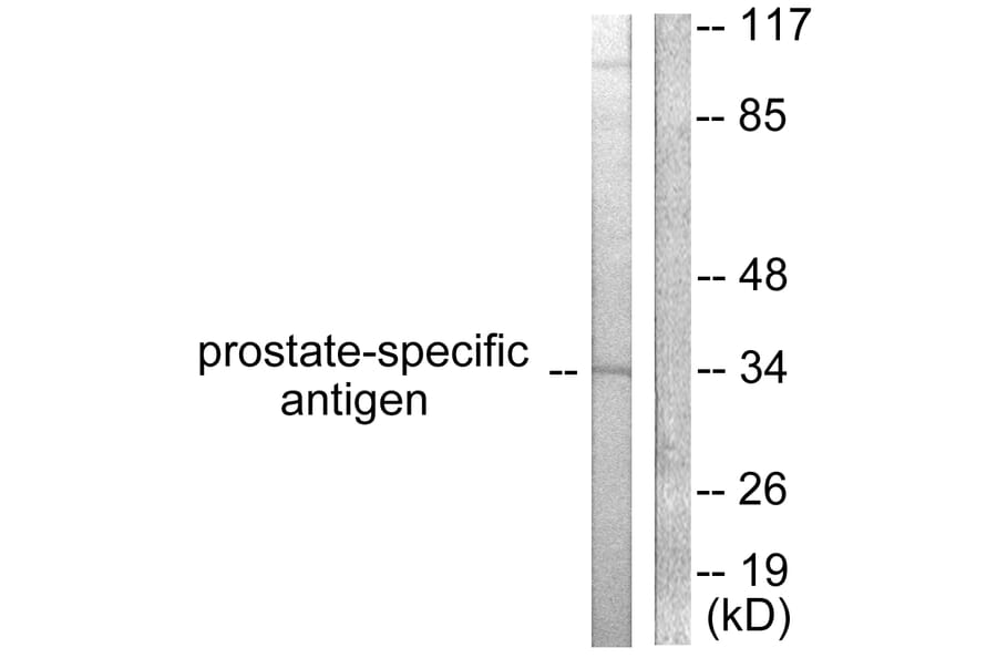 Western Blot - Anti-Prostate-specific Antigen Antibody (C0311) - Antibodies.com