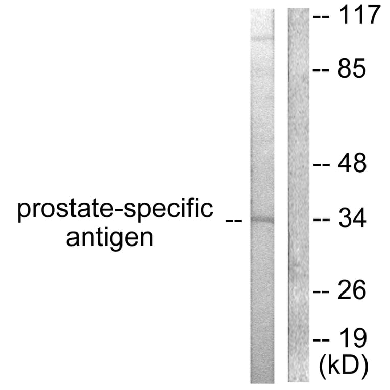 Western Blot - Anti-Prostate-specific Antigen Antibody (C0311) - Antibodies.com