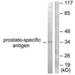 Western Blot - Anti-Prostate-specific Antigen Antibody (C0311) - Antibodies.com