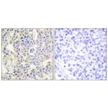 Immunohistochemistry - Anti-PKC thet (phospho Ser695) Antibody (A0804) - Antibodies.com