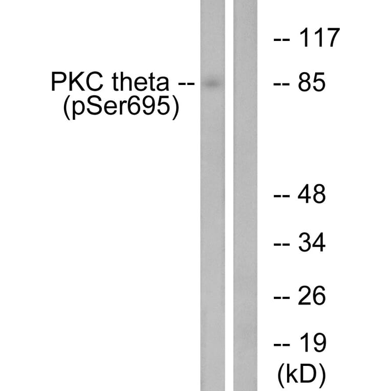 Western Blot - Anti-PKC thet (phospho Ser695) Antibody (A0804) - Antibodies.com