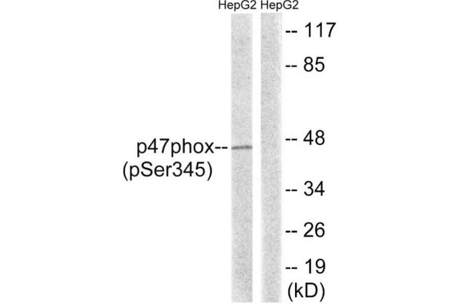 Western Blot - Anti-p47 phox (phospho Ser345) Antibody (A8391) - Antibodies.com