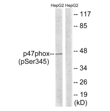 Western Blot - Anti-p47 phox (phospho Ser345) Antibody (A8391) - Antibodies.com