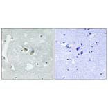 Immunohistochemistry - Anti-p47 phox (phospho Ser345) Antibody (A8391) - Antibodies.com