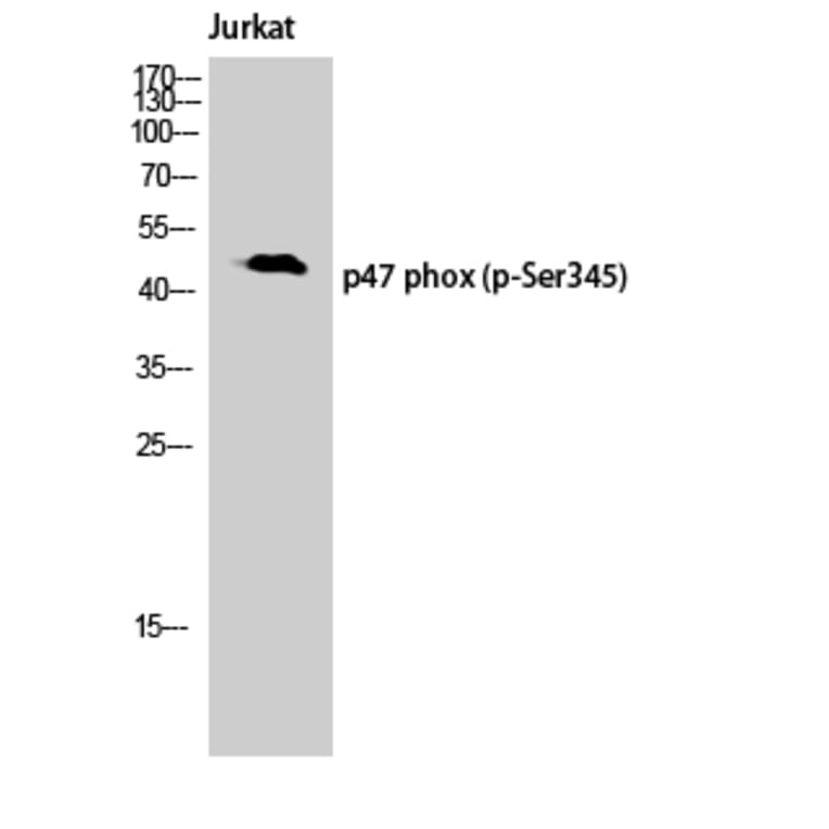 Western Blot - Anti-p47 phox (phospho Ser345) Antibody (A8391) - Antibodies.com