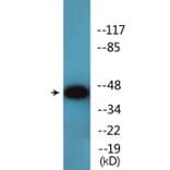 Western Blot - Anti-p47 phox (phospho Ser345) Antibody (P12-1159) - Antibodies.com