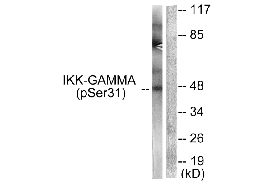Western Blot - Anti-IKK-gamma (phospho Ser31) Antibody (A0443) - Antibodies.com