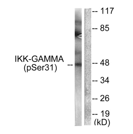 Western Blot - Anti-IKK-gamma (phospho Ser31) Antibody (A0443) - Antibodies.com