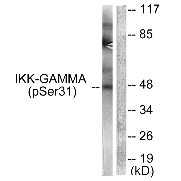 Western Blot - Anti-IKK-gamma (phospho Ser31) Antibody (A0443) - Antibodies.com