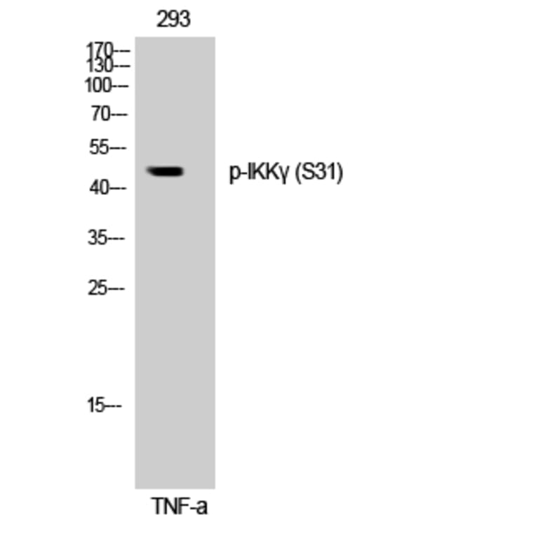 Western Blot - Anti-IKK-gamma (phospho Ser31) Antibody (A0443) - Antibodies.com