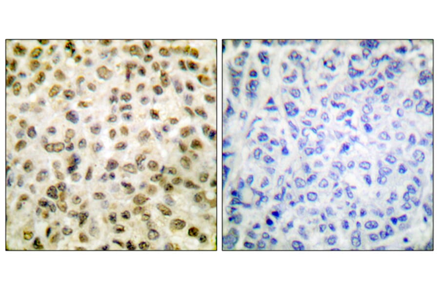 Immunohistochemistry - Anti-Histone H1 (acetyl Lys25) Antibody (D0001) - Antibodies.com