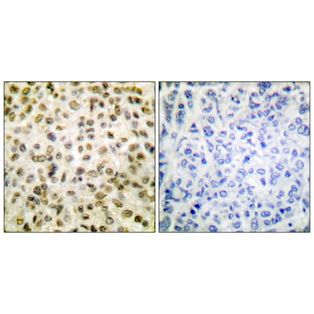 Immunohistochemistry - Anti-Histone H1 (acetyl Lys25) Antibody (D0001) - Antibodies.com