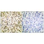 Immunohistochemistry - Anti-Histone H1 (acetyl Lys25) Antibody (D0001) - Antibodies.com