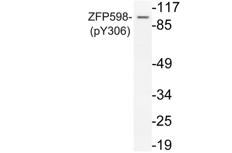 Western Blot - Anti-ZFP598 (phospho Tyr306) Antibody (P12-1068) - Antibodies.com
