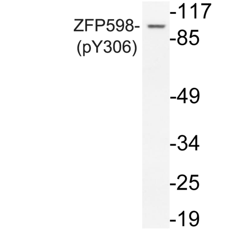 Western Blot - Anti-ZFP598 (phospho Tyr306) Antibody (P12-1068) - Antibodies.com
