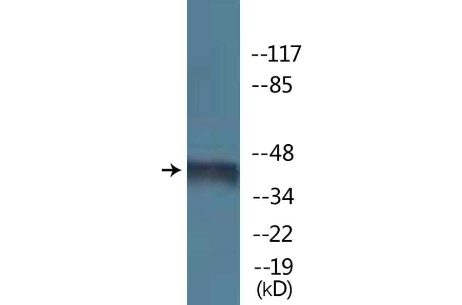 Western Blot - Anti-Kir6.2 (phospho Thr224) Antibody (P12-1131) - Antibodies.com