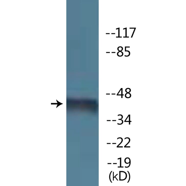 Western Blot - Anti-Kir6.2 (phospho Thr224) Antibody (P12-1131) - Antibodies.com