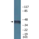 Western Blot - Anti-Kir6.2 (phospho Thr224) Antibody (P12-1131) - Antibodies.com
