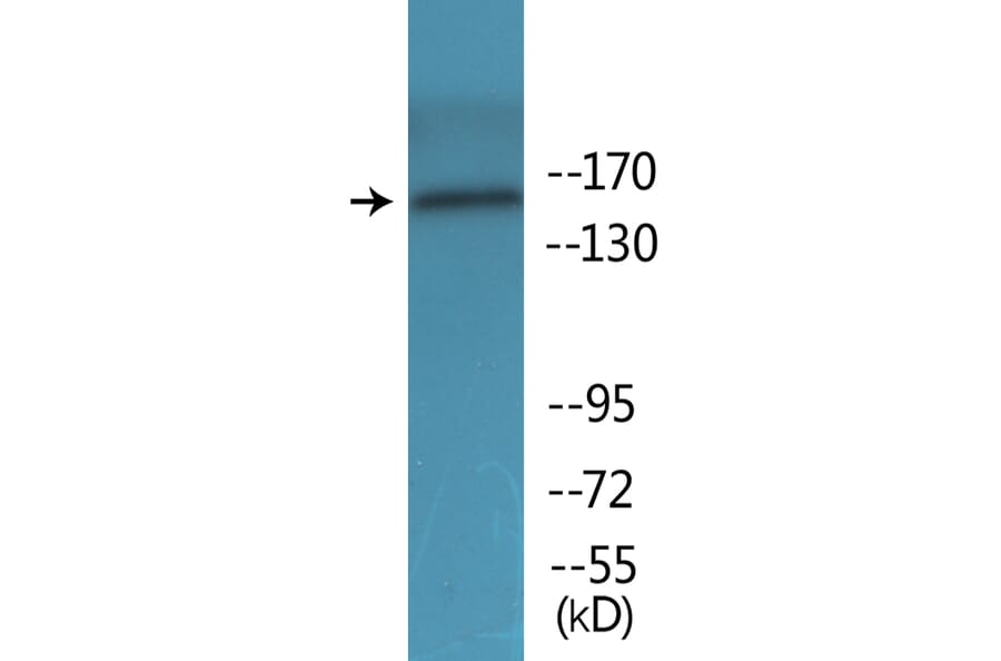 Western Blot - Anti-FANCA (phospho Ser1149) Antibody (P12-1105) - Antibodies.com