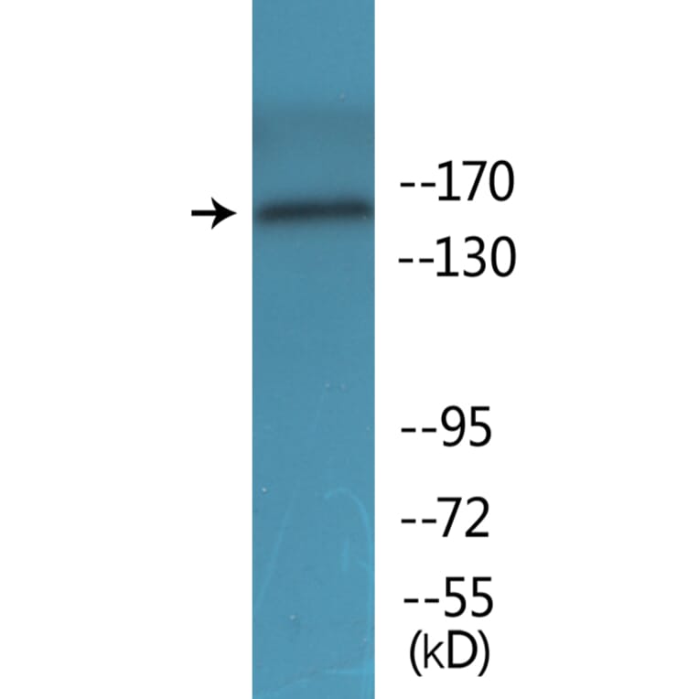 Western Blot - Anti-FANCA (phospho Ser1149) Antibody (P12-1105) - Antibodies.com