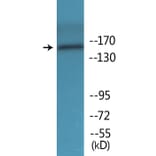 Western Blot - Anti-FANCA (phospho Ser1149) Antibody (P12-1105) - Antibodies.com